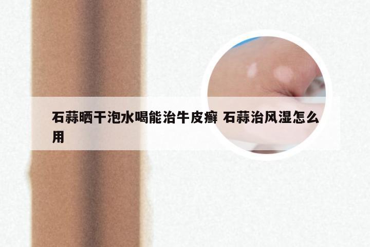 石蒜晒干泡水喝能治牛皮癣 石蒜治风湿怎么用