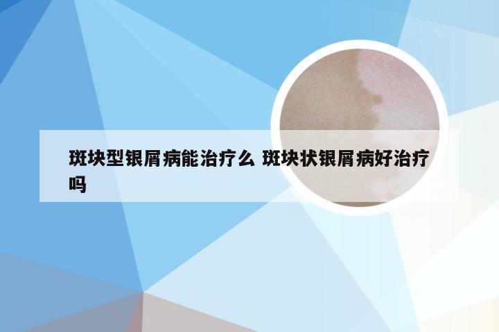 斑块型银屑病能治疗么 斑块状银屑病好治疗吗