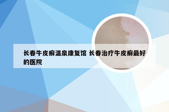 长春牛皮癣温泉康复馆 长春治疗牛皮癣最好的医院