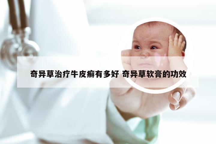奇异草治疗牛皮癣有多好 奇异草软膏的功效
