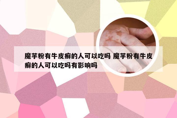 魔芋粉有牛皮癣的人可以吃吗 魔芋粉有牛皮癣的人可以吃吗有影响吗