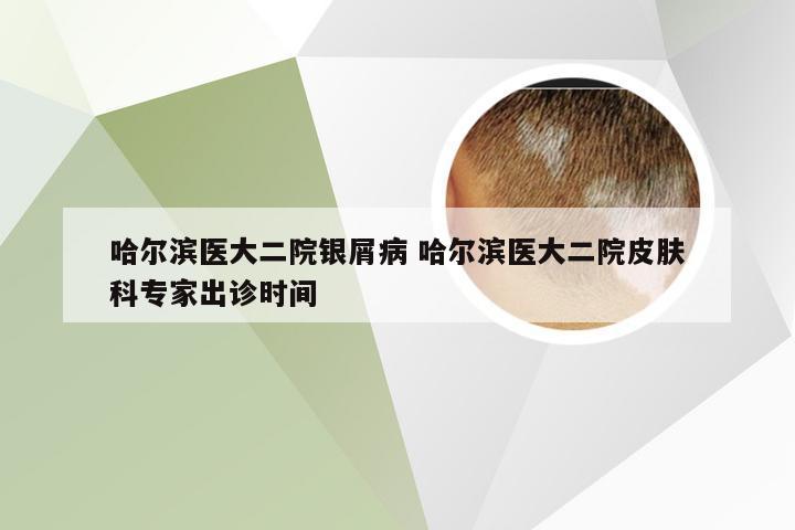 哈尔滨医大二院银屑病 哈尔滨医大二院皮肤科专家出诊时间