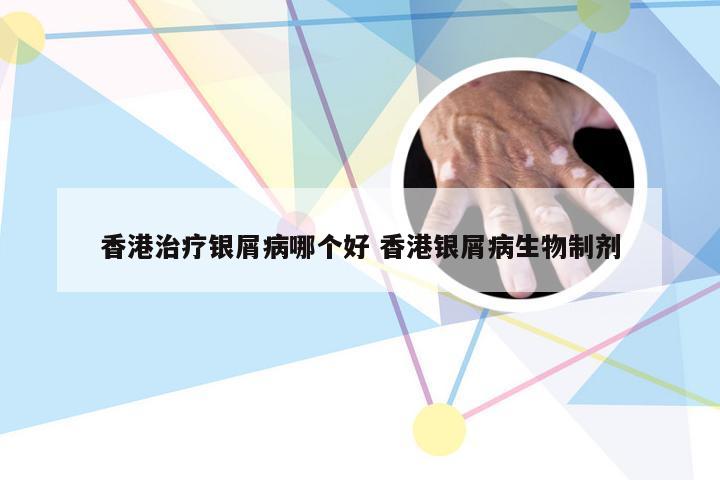 香港治疗银屑病哪个好 香港银屑病生物制剂