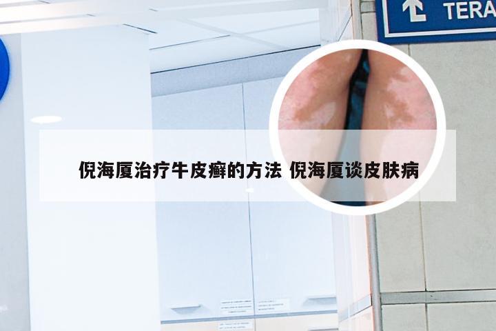 倪海厦治疗牛皮癣的方法 倪海厦谈皮肤病