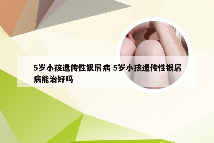 5岁小孩遗传性银屑病 5岁小孩遗传性银屑病能治好吗