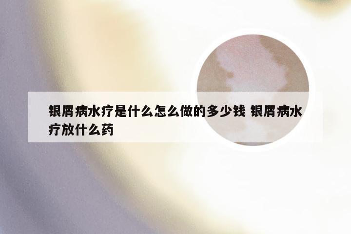 银屑病水疗是什么怎么做的多少钱 银屑病水疗放什么药
