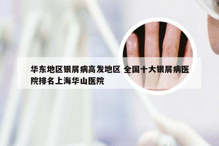 华东地区银屑病高发地区 全国十大银屑病医院排名上海华山医院