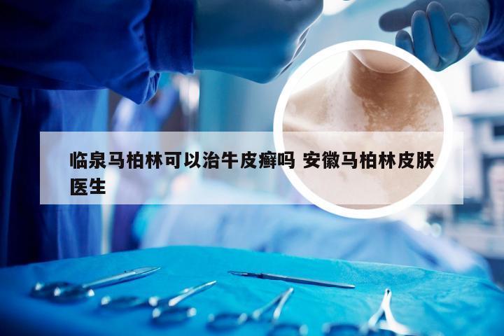 临泉马柏林可以治牛皮癣吗 安徽马柏林皮肤医生