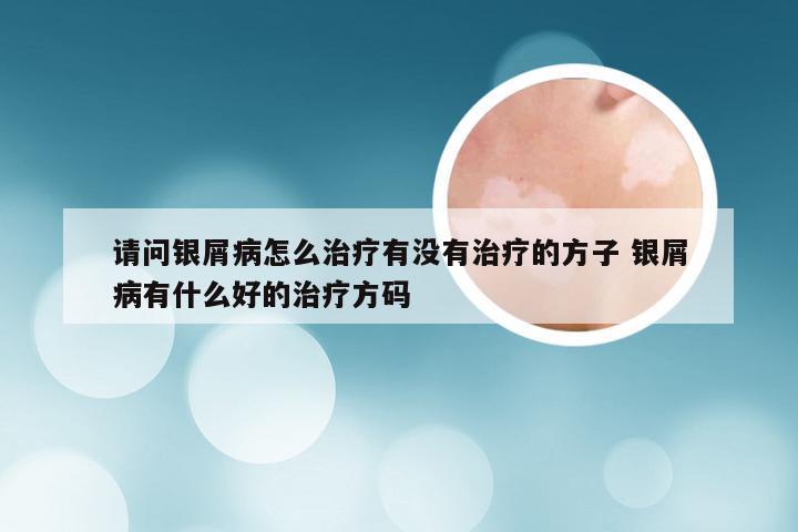 请问银屑病怎么治疗有没有治疗的方子 银屑病有什么好的治疗方码