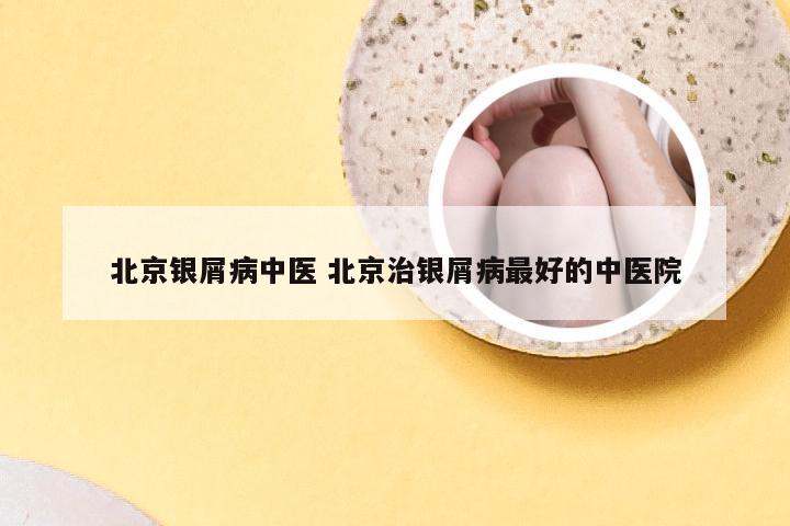 北京银屑病中医 北京治银屑病最好的中医院