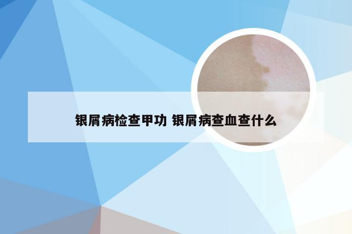 银屑病检查甲功 银屑病查血查什么