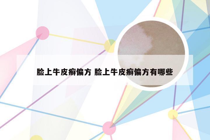 脸上牛皮癣偏方 脸上牛皮癣偏方有哪些