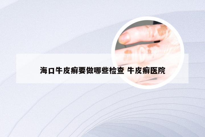 海口牛皮癣要做哪些检查 牛皮癣医院