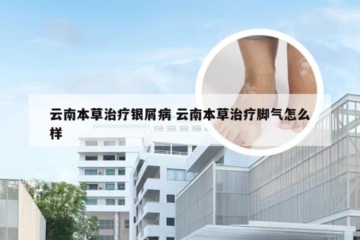 云南本草治疗银屑病 云南本草治疗脚气怎么样