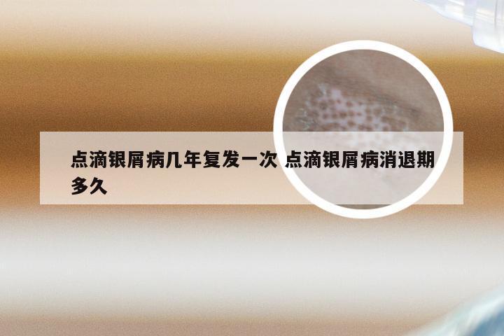 点滴银屑病几年复发一次 点滴银屑病消退期多久