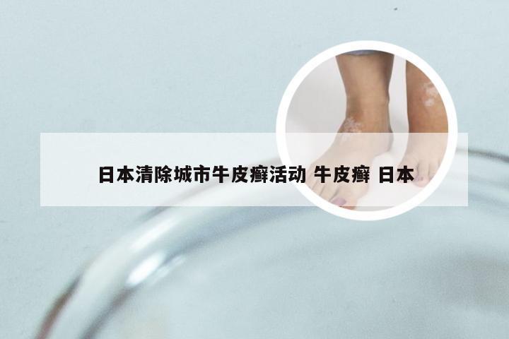 日本清除城市牛皮癣活动 牛皮癣 日本