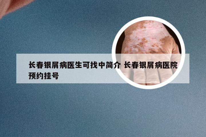 长春银屑病医生可找中简介 长春银屑病医院预约挂号
