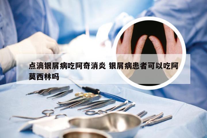 点滴银屑病吃阿奇消炎 银屑病患者可以吃阿莫西林吗