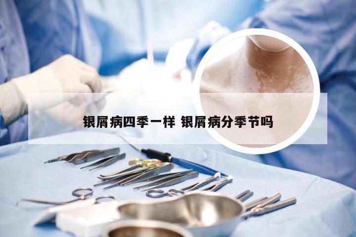 银屑病四季一样 银屑病分季节吗