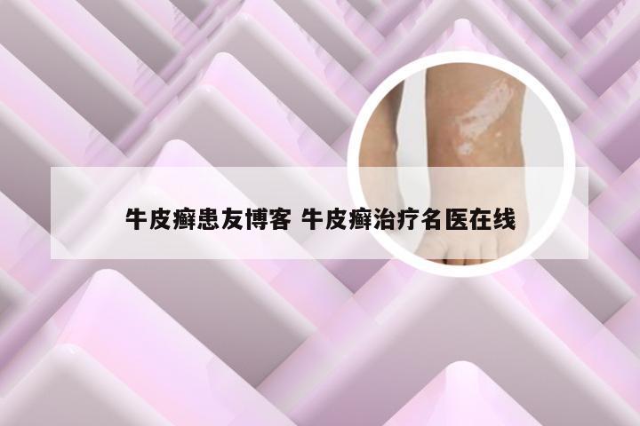 牛皮癣患友博客 牛皮癣治疗名医在线