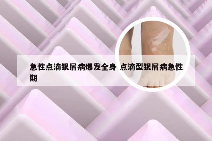 急性点滴银屑病爆发全身 点滴型银屑病急性期