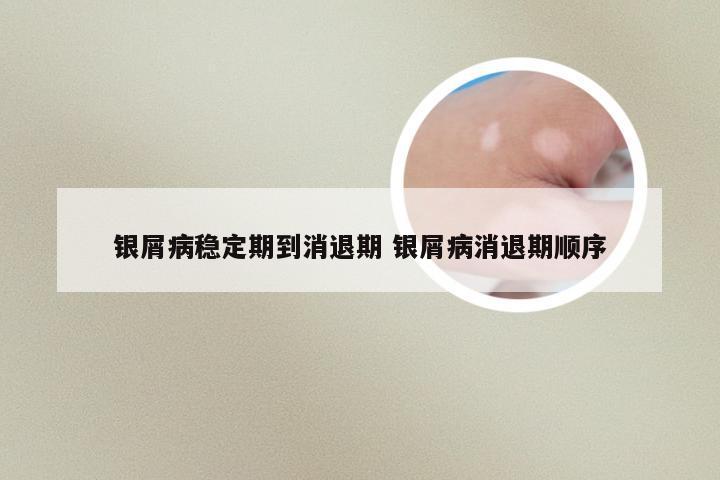 银屑病稳定期到消退期 银屑病消退期顺序