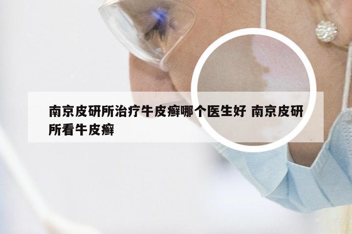 南京皮研所治疗牛皮癣哪个医生好 南京皮研所看牛皮癣