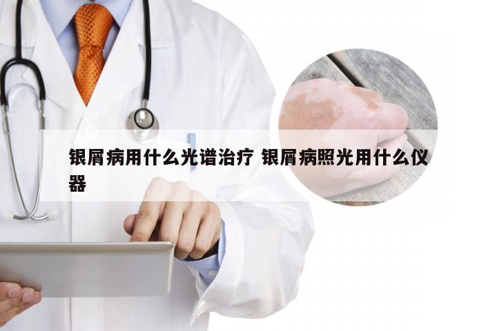 银屑病用什么光谱治疗 银屑病照光用什么仪器