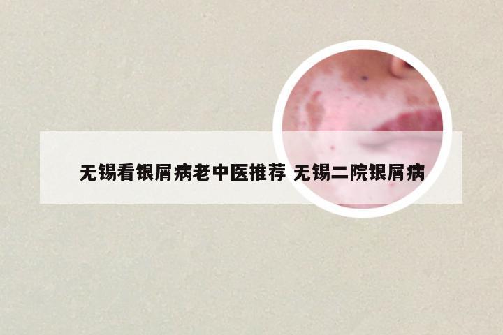 无锡看银屑病老中医推荐 无锡二院银屑病
