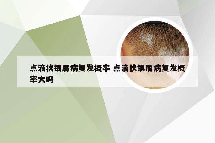 点滴状银屑病复发概率 点滴状银屑病复发概率大吗