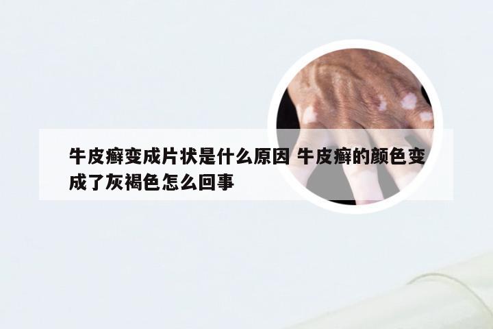 牛皮癣变成片状是什么原因 牛皮癣的颜色变成了灰褐色怎么回事