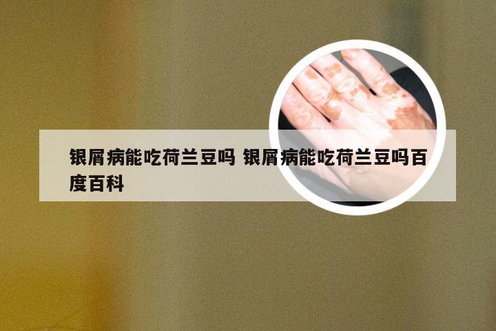 银屑病能吃荷兰豆吗 银屑病能吃荷兰豆吗百度百科