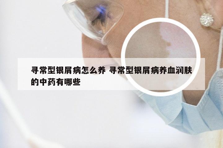 寻常型银屑病怎么养 寻常型银屑病养血润肤的中药有哪些