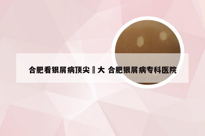 合肥看银屑病顶尖軍大 合肥银屑病专科医院