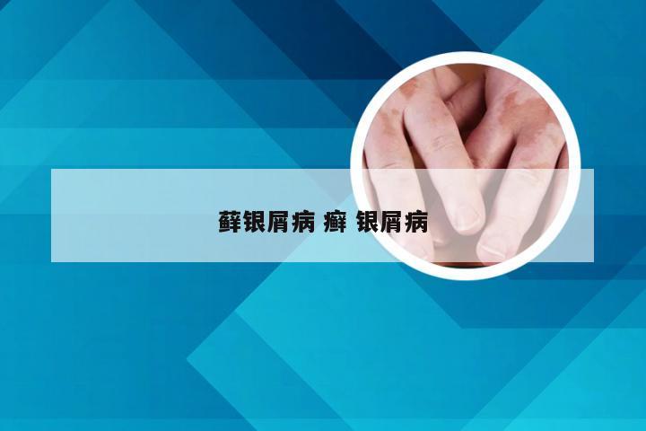 藓银屑病 癣 银屑病