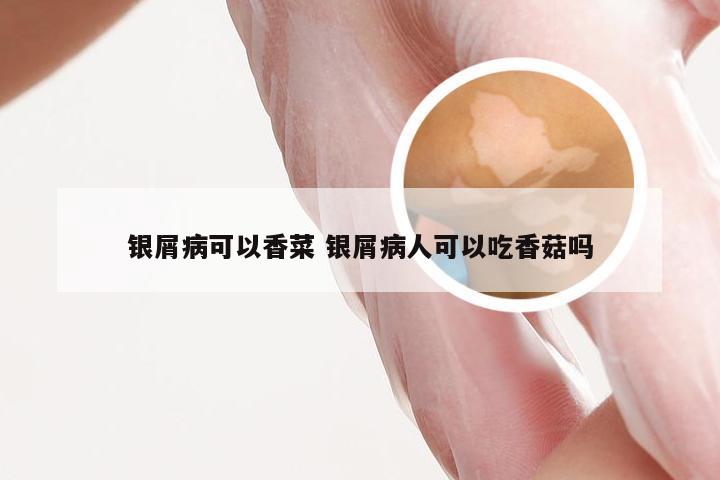 银屑病可以香菜 银屑病人可以吃香菇吗