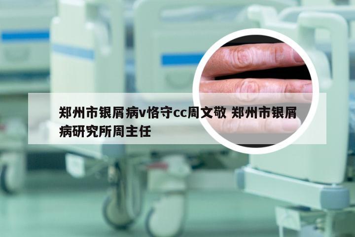 郑州市银屑病v恪守cc周文敬 郑州市银屑病研究所周主任