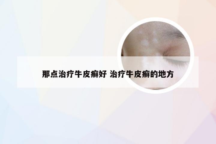 那点治疗牛皮癣好 治疗牛皮癣的地方