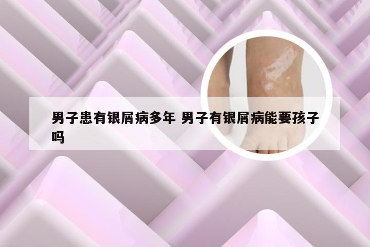 男子患有银屑病多年 男子有银屑病能要孩子吗