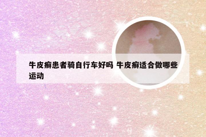 牛皮癣患者骑自行车好吗 牛皮癣适合做哪些运动