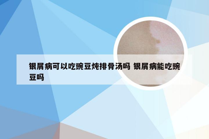 银屑病可以吃豌豆炖排骨汤吗 银屑病能吃豌豆吗