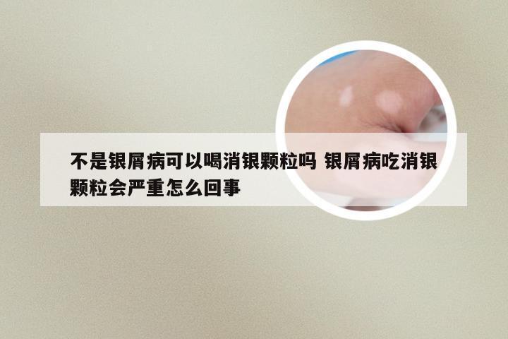 不是银屑病可以喝消银颗粒吗 银屑病吃消银颗粒会严重怎么回事