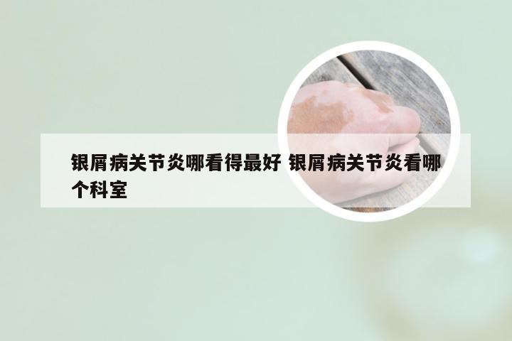 银屑病关节炎哪看得最好 银屑病关节炎看哪个科室