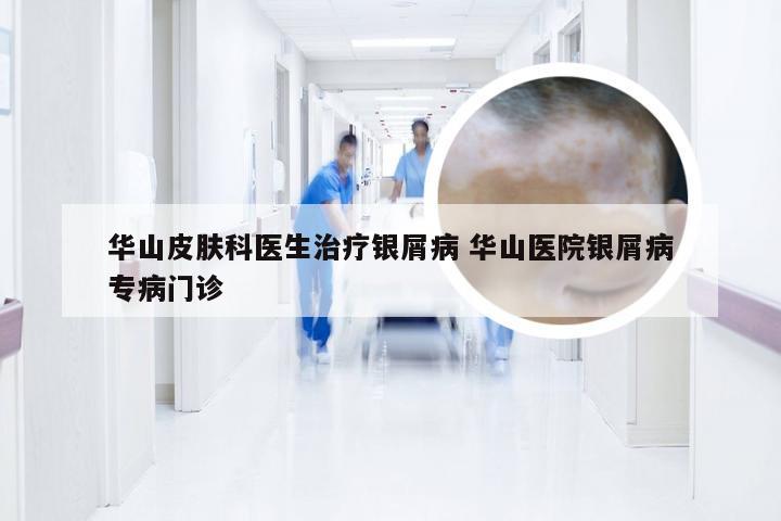 华山皮肤科医生治疗银屑病 华山医院银屑病专病门诊