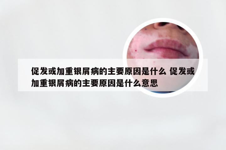 促发或加重银屑病的主要原因是什么 促发或加重银屑病的主要原因是什么意思