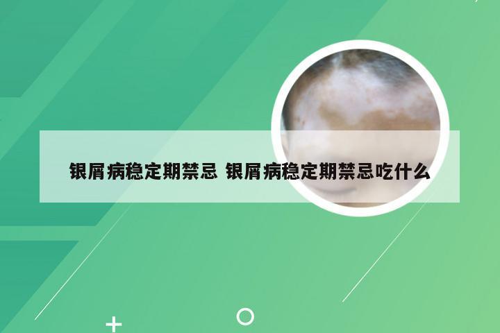 银屑病稳定期禁忌 银屑病稳定期禁忌吃什么