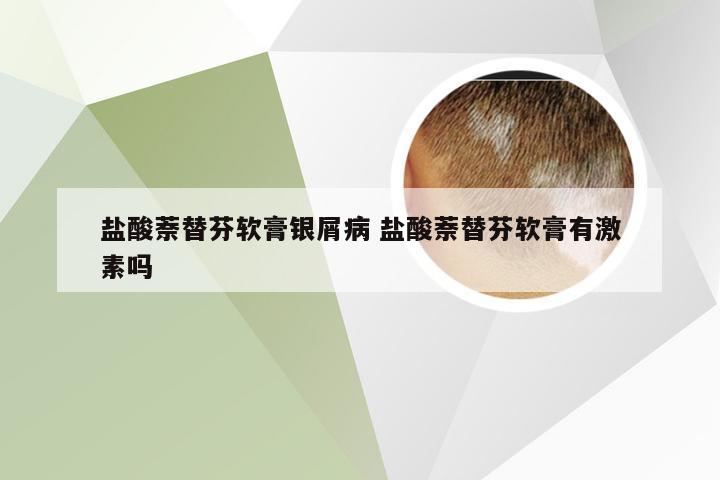 盐酸萘替芬软膏银屑病 盐酸萘替芬软膏有激素吗