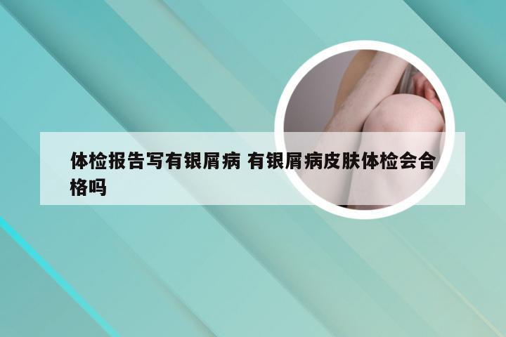 体检报告写有银屑病 有银屑病皮肤体检会合格吗