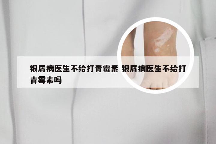 银屑病医生不给打青霉素 银屑病医生不给打青霉素吗