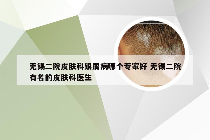 无锡二院皮肤科银屑病哪个专家好 无锡二院有名的皮肤科医生